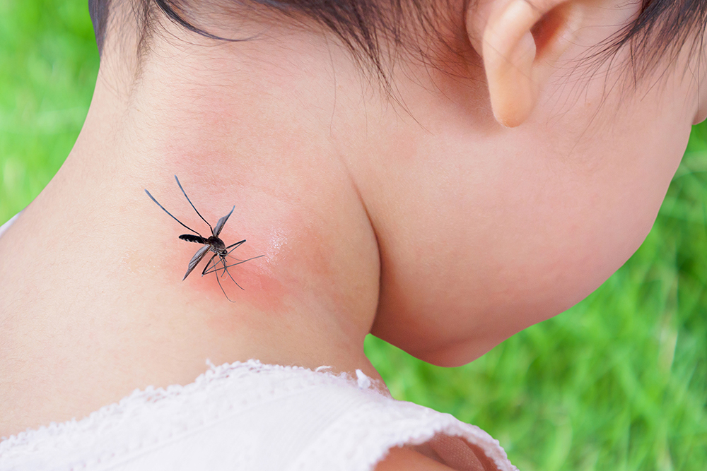 Insectenstichallergien Behandlung in Herne